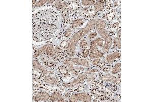 Immunohistochemistry (Paraffin-embedded Sections) (IHC (p)) image for anti-BRCA1 Associated Protein-1 (Ubiquitin Carboxy-terminal Hydrolase) (BAP1) (AA 36-66) antibody (ABIN388948)