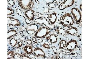 Immunohistochemical staining of paraffin-embedded Kidney tissue using anti-MTRF1L mouse monoclonal antibody. (MTRF1L antibody)