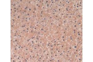 IHC-P analysis of Human Liver Tissue, with DAB staining. (TGFB3 antibody  (AA 24-300))