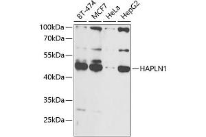 Western blot analysis of extracts of various cell lines, using H antibody (ABIN6129787, ABIN6141601, ABIN6141603 and ABIN6216048) at 1:1000 dilution. (HAPLN1 抗体  (AA 165-354))