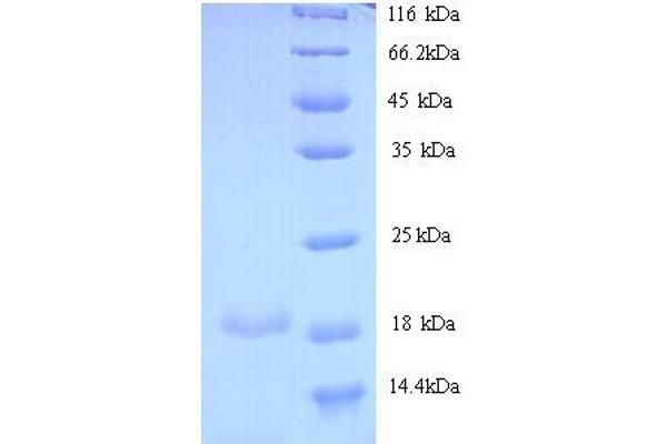 Betacellulin Protein (BTC) (AA 32-118) (His tag)