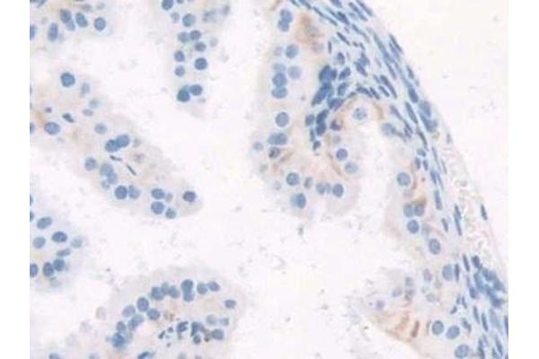 WISP1 antibody  (AA 213-350)