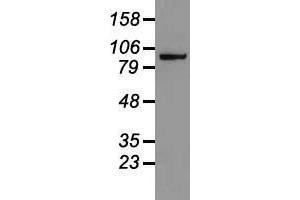 Western blot analysis of 35 µg of cell extracts from human colon adenocarcinoma (HT29) cells using anti-CTNNB1 antibody. (CTNNB1 antibody  (AA 531-781))