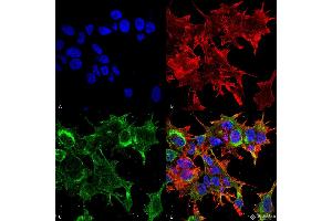 Immunocytochemistry/Immunofluorescence analysis using Mouse Anti-GFAP R416WT Monoclonal Antibody, Clone S206B-9 . (GFAP antibody  (AA 411-422) (Atto 488))