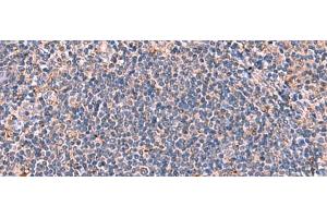 Immunohistochemistry of paraffin-embedded Human tonsil tissue using FDXR Polyclonal Antibody at dilution of 1:85(x200) (Ferredoxin Reductase antibody)