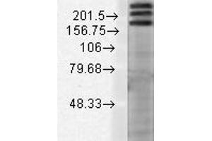 SHANK1 Western Blot. (SHANK1 antibody  (Internal Region))