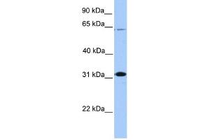 WB Suggested Anti-CITED2 Antibody Titration:  0. (CITED2 antibody  (N-Term))