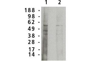 Western blot analysis using acid  sphingomyelinase antibody on normal human brain lysate (7 µg/lane). (SMPD1 antibody)