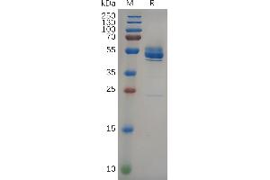 Human Protein, hFc Tag on SDS-PAGE under reducing condition. (FZD10 Protein (AA 21-161) (Fc Tag))