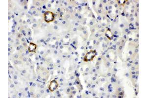 IHC analysis of ISG15/Ucrp using anti- ISG15/Ucrp antibody . (ISG15 antibody  (AA 2-155))