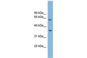 Image no. 1 for anti-Peroxisomal Biogenesis Factor 26 (PEX26) (AA 179-228) antibody (ABIN6744112) (PEX26 antibody  (AA 179-228))