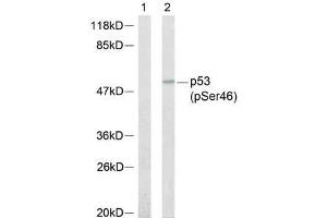 Western blot analysis of extracts from 293 cells, using p53 (phospho-Ser46) antibody (E011099). (p53 antibody  (pSer46))