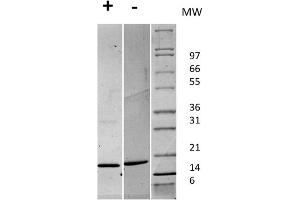 SDS-PAGE of Human Fibroblast Growth Factor 147 basic Recombinant Protein SDS-PAGE of Human Fibroblast Growth Factor 147 basic Recombinant Protein. (FGF2 Protein)