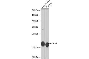 Western blot analysis of extracts of various cell lines, using OP antibody (ABIN6132870, ABIN6145033, ABIN6145034 and ABIN6224015) at 1:1000 dilution. (OPA3 antibody  (AA 25-179))