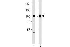 Western blot analysis of lysate from (1) HeLa and (2) Ramos cell line using SP1 antibody at 1:1000. (SP1 antibody)