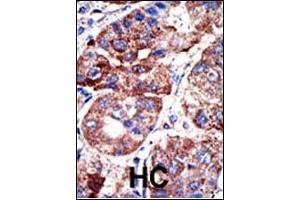 Immunohistochemistry (Paraffin-embedded Sections) (IHC (p)) image for anti-Sequestosome 1 (SQSTM1) (AA 317-346) antibody (ABIN388979)