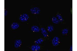 Immunocytochemistry (ICC) image for anti-Tubulin, gamma 1 (TUBG1) (C-Term) antibody (ABIN94313)