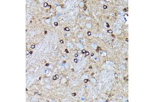 Immunohistochemistry of paraffin-embedded rat brain using Argonaute-2 antibody (ABIN7265671) at dilution of 1:100 (40x lens). (AGO2 antibody)