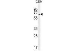 COX10 Antibody (C-term) western blot analysis in CEM cell line lysates (35µg/lane). (COX10 antibody  (C-Term))