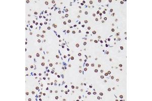 Immunohistochemistry of paraffin-embedded mouse kidney using H1F0 antibody (ABIN5971687) at dilution of 1/100 (40x lens). (Histone H1 antibody)