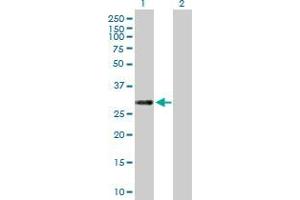 Lane 1: ERP27 transfected lysate ( 30. (C12orf46 293T Cell Transient Overexpression Lysate(Denatured))