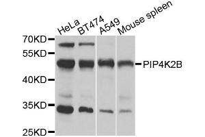 Western blot analysis of extracts of various cell lines, using PIP4K2B antibody (ABIN6292246) at 1:1000 dilution. (PIP4K2B antibody)