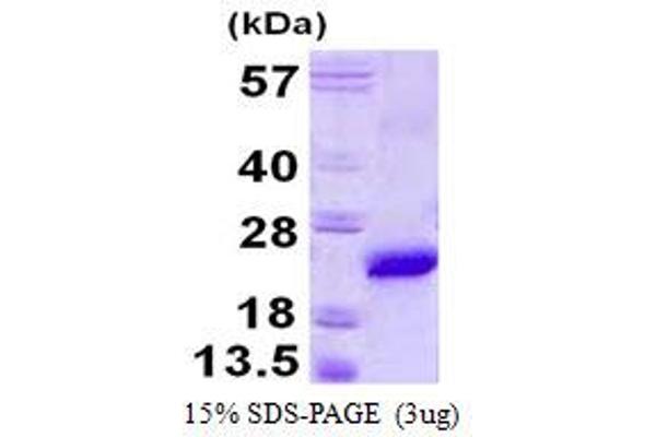 VPS29 Protein (His tag)