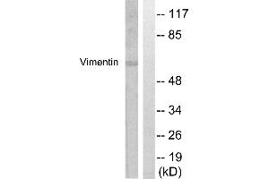 Western blot analysis of lysates from A549 cells, treated with Nocodazole 1ug/ml 16h, using Vimentin Antibody. (Vimentin antibody  (Ser56))