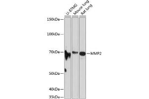 Western blot analysis of extracts of various cell lines, using MMP2 antibody (ABIN7268428) at 1:1000 dilution. (MMP2 antibody)