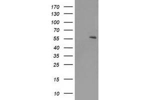 HEK293T cells were transfected with the pCMV6-ENTRY control (Left lane) or pCMV6-ENTRY PPARA (Right lane) cDNA for 48 hrs and lysed. (PPARA antibody  (AA 145-420))