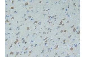 IHC-P analysis of Human Brain Tissue, with DAB staining. (SMAD9 antibody  (AA 226-459))