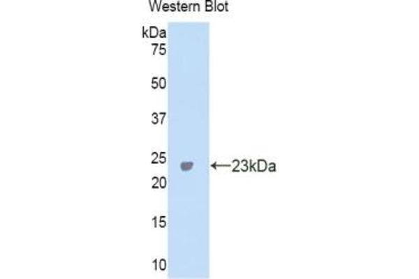 CA5A antibody  (AA 7-179)