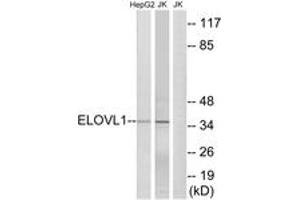 Western Blotting (WB) image for anti-ELOVL Fatty Acid Elongase 1 (ELOVL1) (AA 101-150) antibody (ABIN2890301) (ELOVL1 antibody  (AA 101-150))