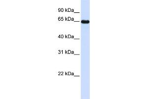WB Suggested Anti-LMOD1 Antibody Titration: 0. (Leiomodin 1 antibody  (N-Term))