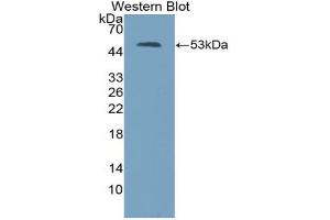 Western blot analysis of the recombinant protein. (Thrombospondin 2 antibody  (AA 968-1170))