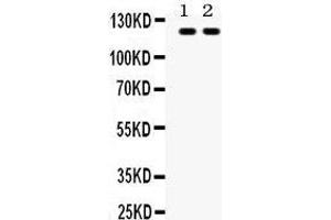 Anti- TLR8 antibody, Western blotting All lanes: Anti TLR8  at 0. (TLR8 antibody  (C-Term))