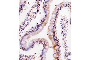 Immunohistochemical analysis of paraffin-embedded rat small intestine section using Rat Cdk4 Antibody (C-term) B. (CDK4 antibody  (C-Term))