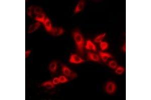 Immunofluorescent analysis of MYL2 staining in MCF7 cells. (MYL2 antibody)