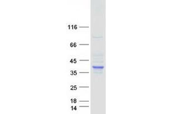 serine Dehydratase Protein (SDS) (Myc-DYKDDDDK Tag)