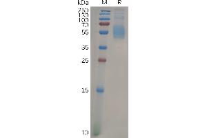 Human SIG Protein, His Tag on SDS-PAGE under reducing condition. (SIGLEC7 Protein (AA 19-353) (His tag))