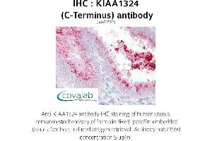 Image no. 1 for anti-Endosome/Lysosome-associated Apoptosis and Autophagy Regulator 1 (ELAPOR1) antibody (ABIN1736217) (ELAPOR1 antibody)