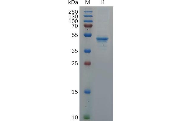 GDNF Protein (AA 78-211) (Fc Tag)