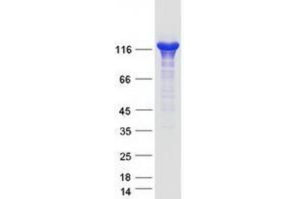 Tpp2 Protein (Myc-DYKDDDDK Tag)