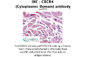 Image no. 1 for anti-Chemokine (C-X-C Motif) Receptor 4 (CXCR4) antibody (ABIN1733405) (CXCR4 antibody)