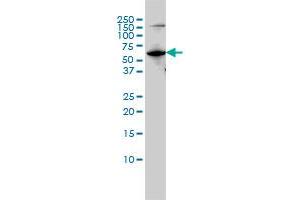 MUTYH monoclonal antibody (M01), clone 4D10 Western Blot analysis of MUTYH expression in Hela S3 NE . (MUTYH antibody  (AA 436-535))