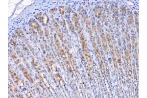 IHC analysis of TFF2 using anti-TFF2 antibody . (Trefoil Factor 2 antibody  (AA 24-129))