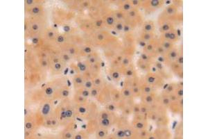 IHC-P analysis of liver tissue, with DAB staining. (C3 antibody  (AA 965-1303))