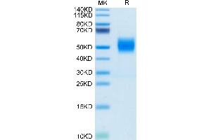 Biotinylated Human FGFR2 beta (IIIc) on Tris-Bis PAGE under reduced condition. (FGFR2 beta (AA 152-377) protein (His-Avi Tag,Biotin))