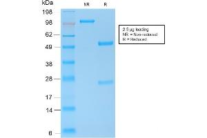 SDS-PAGE (SDS) image for anti-Cadherin 1, Type 1, E-Cadherin (Epithelial) (CDH1) antibody (ABIN6941299)