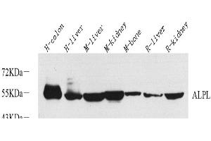 Western Blot analysis of various samples using ALPL Polyclonal Antibody at dilution of 1:1000. (ALPL antibody)